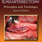 خرید و دانلود نسخه کامل کتاب Carotid Endarterectomy: Principles and Technique, Second Edition