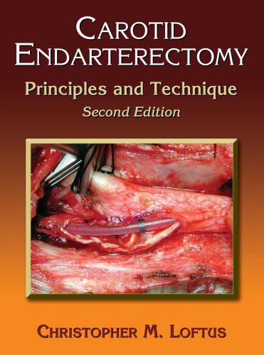 خرید و دانلود نسخه کامل کتاب Carotid Endarterectomy: Principles and Technique, Second Edition_68c8ddf813f85.jpeg خرید و دانلود نسخه کامل کتاب Carotid Endarterectomy: Principles and Technique, Second Edition