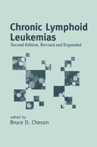 خرید و دانلود نسخه کامل کتاب Chronic Lymphoid Leukemias, Second Edition, (Basic and Clinical Oncology)_68cb9a9cde8b0.jpeg خرید و دانلود نسخه کامل کتاب Chronic Lymphoid Leukemias, Second Edition, (Basic and Clinical Oncology)