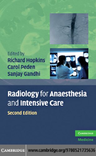 خرید و دانلود نسخه کامل کتاب Radiology for Anaesthesia and Intensive Care_68c96bc61e211.jpeg خرید و دانلود نسخه کامل کتاب Radiology for Anaesthesia and Intensive Care
