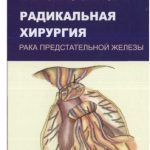 خرید و دانلود نسخه کامل کتاب Радикальная хирургия рака предстательной железы