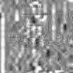 خرید و دانلود نسخه کامل کتاب Toxic Bodies: Hormone Disruptors and the Legacy of DES