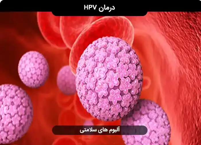 خرید-و-دانلود-فایل-پاکسازی-ویروس-hpv-از-بدن-درمان-اچ-پی-وی- خرید و دانلود فایل کتاب پاکسازی ویروس hpv از بدن ( درمان اچ پی وی ) | سورنا بوک - تصویر 1