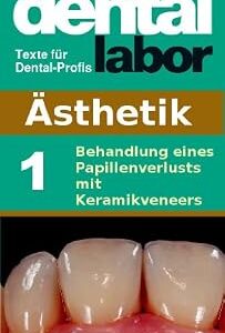خرید و دانلود نسخه کامل کتاب Behandlung eines Papillenverlusts mit Keramikveneers (das dental labor Fachtexte 13) (German Edition)