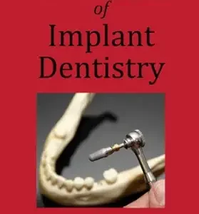 خرید و دانلود نسخه کامل کتاب The Little Red Book of Implant Dentistry (Everyday Implant Dentistry’s Little Red Guides 1)