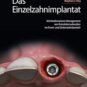خرید و دانلود نسخه کامل کتاب Das Einzelzahnimplantat: Minimalinvasives Management von Extraktionsalveolen im Front- und Seitenzahnbereich (German Edition)