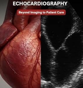 خرید و دانلود نسخه کامل کتاب Echocardiography for Cardiovascular Technologists: Beyond Imaging to Patient Care: A Practical Guide to 2D Echo, Doppler Techniques, and Clinical Applications … Cardiac Diagnostics & Interventions)