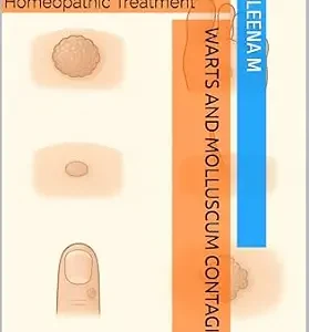 خرید و دانلود نسخه کامل کتاب Warts and Molluscum Contagiosum: A Comprehensive Guide to Homeopathic Treatment”