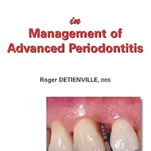 خرید و دانلود نسخه کامل کتاب Clinical Success in Management of Advanced Periodontitis