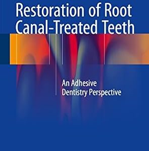 خرید و دانلود نسخه کامل کتاب Restoration of Root Canal-Treated Teeth: An Adhesive Dentistry Perspective