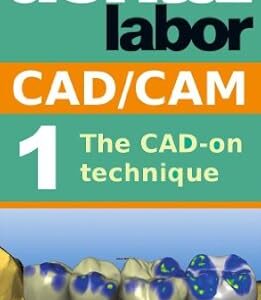 خرید و دانلود نسخه کامل کتاب The CAD-on technique (dental lab technology articles Book 5)