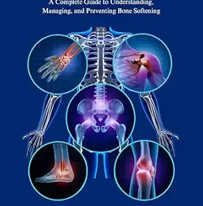 خرید و دانلود نسخه کامل کتاب Osteomalacia: A Complete Guide to Understanding, Managing, and Preventing Bone Softening (The Bone Wellness Guide Series)