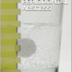 خرید و دانلود نسخه کامل کتاب Periodontal Abscess: A Student Guide