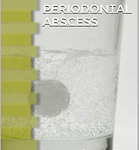 خرید و دانلود نسخه کامل کتاب Periodontal Abscess: A Student Guide