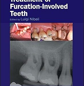 خرید و دانلود نسخه کامل کتاب Diagnosis and Treatment of Furcation-Involved Teeth