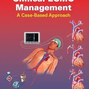خرید و دانلود نسخه کامل کتاب Clinical ECMO Management: A Case-Based Approach