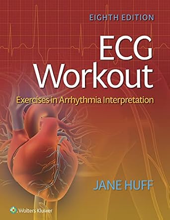 خرید و دانلود نسخه کامل کتاب ECG Workout: Exercises in Arrhythmia Interpretation_6a6cc311b0cde.jpeg خرید و دانلود نسخه کامل کتاب ECG Workout: Exercises in Arrhythmia Interpretation