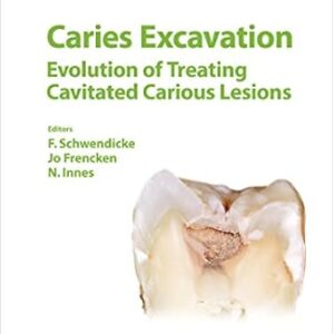 خرید و دانلود نسخه کامل کتاب Caries Excavation: Evolution of Treating Cavitated Carious Lesions (Monographs in Oral Science Book 27)