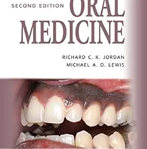 خرید و دانلود نسخه کامل کتاب Oral Medicine (Medical Color Handbook Series)