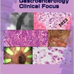 خرید و دانلود نسخه کامل کتاب Gastroenterology Clinical Focus: High Yield GI and Hepatology Review- for Boards and Practice [Print Replica] Kindle Edition