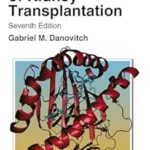 خرید و دانلود نسخه کامل کتاب Handbook of Kidney Transplantation
