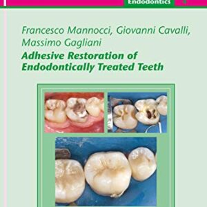 خرید و دانلود نسخه کامل کتاب Adhesive Restoration of Endodontically Treated Teeth: Endodontics 4 (QuintEssentials of Dental Practice Book 40) 1st Edition