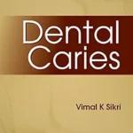 خرید و دانلود نسخه کامل کتاب Dental Caries