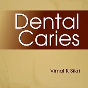 خرید و دانلود نسخه کامل کتاب Dental Caries