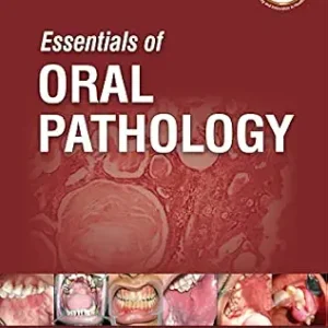خرید و دانلود نسخه کامل کتاب Essentials of Oral Pathology