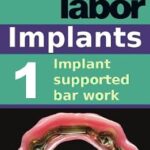 خرید و دانلود نسخه کامل کتاب Implant supported bar work (dental lab technology articles Book 9)