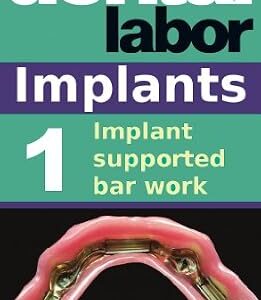 خرید و دانلود نسخه کامل کتاب Implant supported bar work (dental lab technology articles Book 9)
