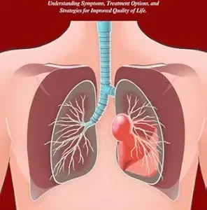 خرید و دانلود نسخه کامل کتاب Pulmonary Hypertension: A Complete Guide for Patients and Caregivers: Understanding Symptoms, Treatment Options, and Strategies for Improved Quality of Life (The Complete Health Guide Collection)