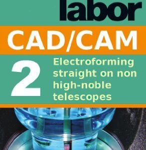 خرید و دانلود نسخه کامل کتاب Electroforming straight on non high-noble telescopes (dental lab technology articles Book 4) Kindle Edition