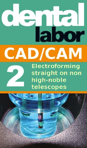 خرید و دانلود نسخه کامل کتاب Electroforming straight on non high-noble telescopes (dental lab technology articles Book 4) Kindle Edition_6a685f9d8e79b.jpeg خرید و دانلود نسخه کامل کتاب Electroforming straight on non high-noble telescopes (dental lab technology articles Book 4) Kindle Edition