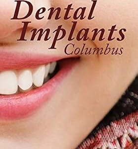 خرید و دانلود نسخه کامل کتاب Dental Implants Columbus