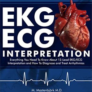 خرید و دانلود نسخه کامل کتاب EKG/ECG Interpretation: Everything you Need to Know about the 12 – Lead ECG/EKG Interpretation and How to Diagnose and Treat Arrhythmias: 2nd Edition Kindle Edition