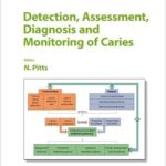 خرید و دانلود نسخه کامل کتاب Detection, Assessment, Diagnosis and Monitoring of Caries (Monographs in Oral Science, Vol. 21)