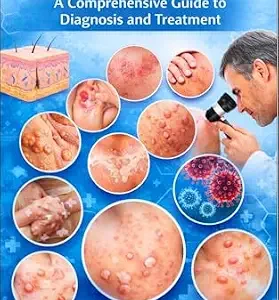خرید و دانلود نسخه کامل کتاب Dermatology: A Comprehensive Guide to Diagnosis and Treatment (Medical Study Books By Sanjay Mandavi Book 3)
