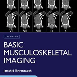 خرید و دانلود نسخه کامل کتاب Basic Musculoskeletal Imaging, Second Edition 2nd Edition