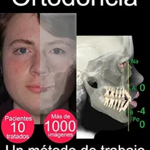 خرید و دانلود نسخه کامل کتاب ORTODONCIA: UN MÉTODO DE TRABAJO (Spanish Edition)