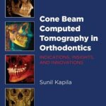 خرید و دانلود نسخه کامل کتاب Cone Beam Computed Tomography in Orthodontics: Indications, Insights, and Innovations
