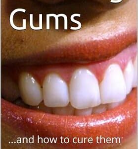 خرید و دانلود نسخه کامل کتاب Bleeding Gums