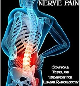 خرید و دانلود نسخه کامل کتاب Sciatica Nerve Pain: Symptoms, Tests, and Treatments for Lumbar Radiculopathy