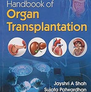خرید و دانلود نسخه کامل کتاب Handbook of Organ Transplantation