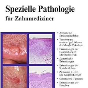 خرید و دانلود نسخه کامل کتاب Curriculum Spezielle Pathologie für Zahnmediziner (German Edition)