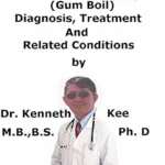 خرید و دانلود نسخه کامل کتاب A Simple Guide To Dental Abscess, (Gum Boil) Diagnosis, Treatment And Related Conditions