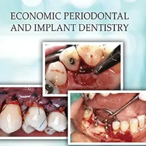 خرید و دانلود نسخه کامل کتاب Economic Periodontal and Implant Dentistry