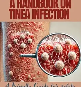 خرید و دانلود نسخه کامل کتاب Fighting Fungi: A Handbook on Tinea Infection