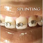 خرید و دانلود نسخه کامل کتاب SPLINTING: In Dentistry