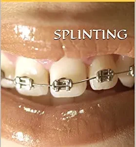 خرید و دانلود نسخه کامل کتاب SPLINTING: In Dentistry